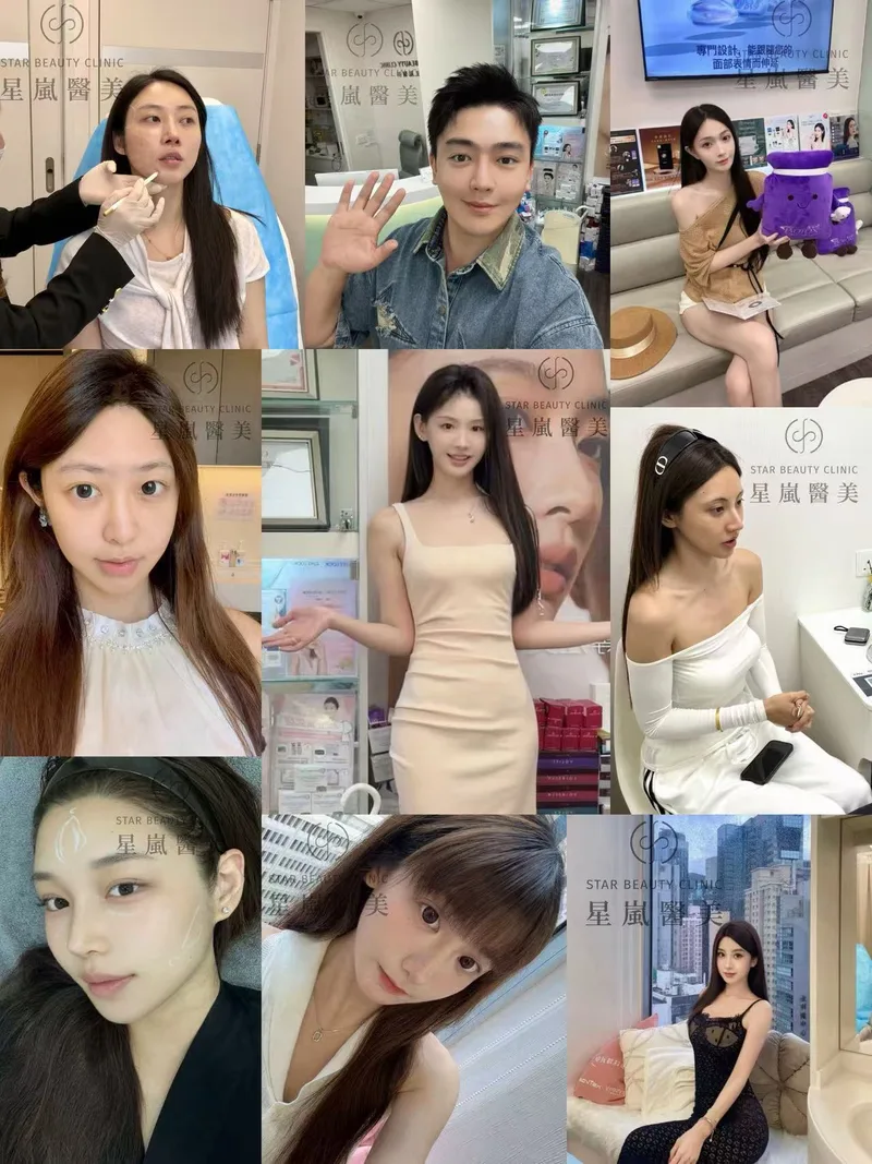 医美前后对比照