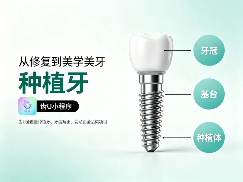 种植牙结构图