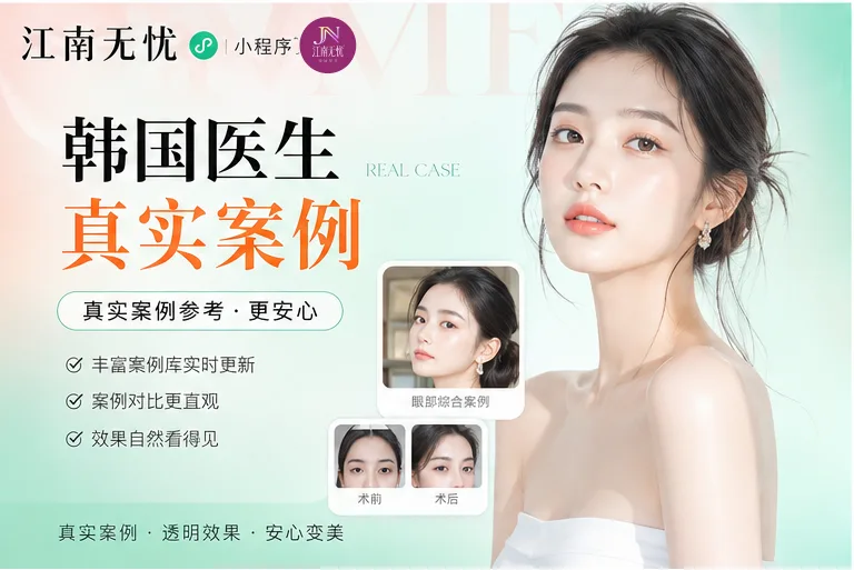 女性眼部整形对比图