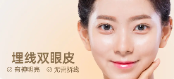【爱护】埋线双眼皮