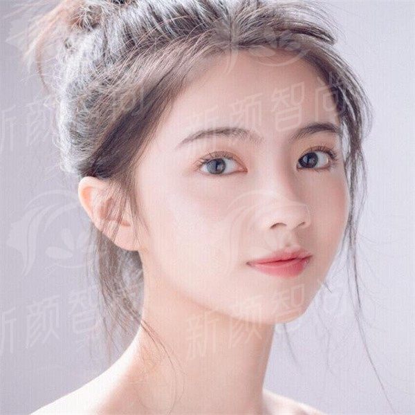 重庆朱乐林轮廓手术做的怎么样？磨骨技术丰富，面部轮廓线条自然，下颌角磨骨3w起~ -上新颜智尚小程序查询/咨询快捷预约