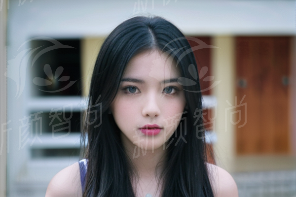 深圳联合会美整形医院少女针