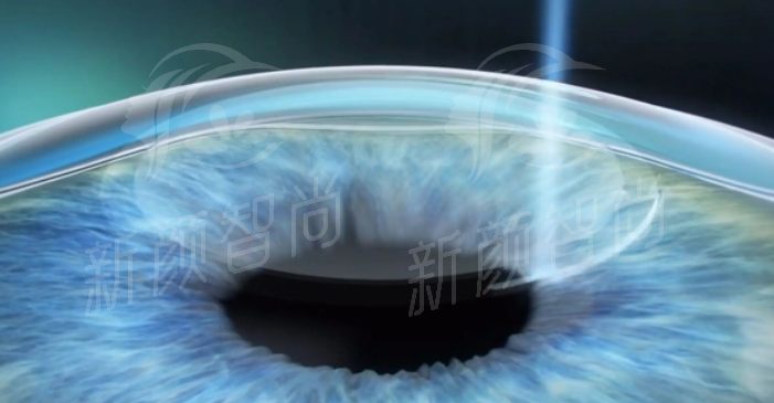 北京茗视光眼科