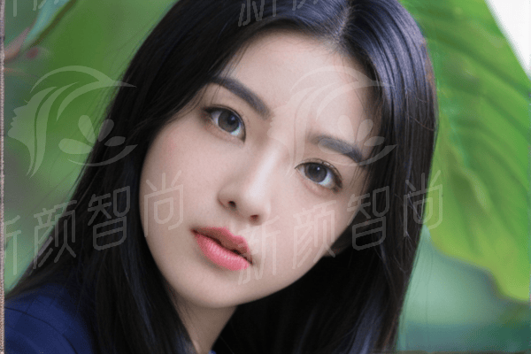 嘉 兴韩辰整形医院周小伟双眼皮眼周年轻化技术优势：精细、自然
