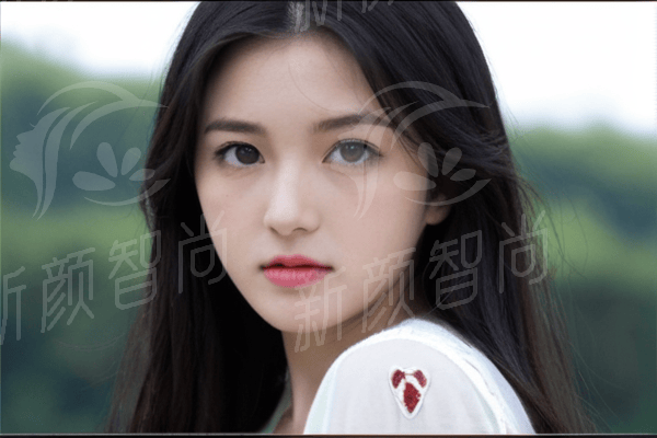 曲靖麦穗植发热门植发项目及价格参考
