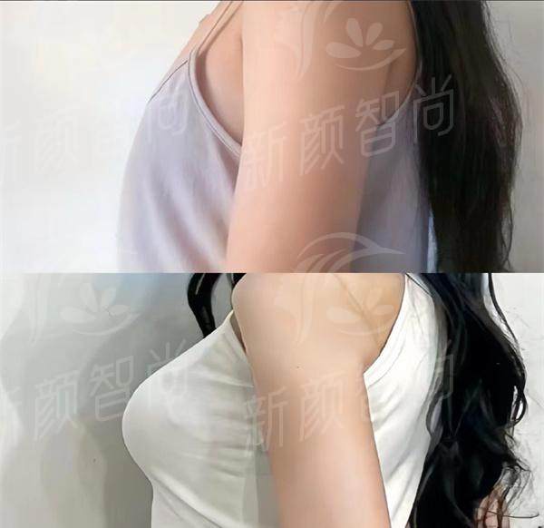 99b626cdly1hs6k0hisa3j20u013y451.jpg