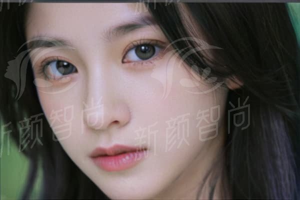 北京劲松口腔医院全程数字化导板种植术