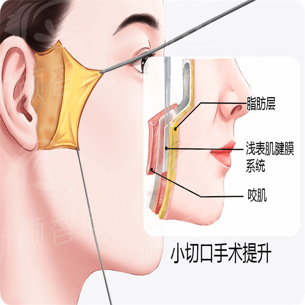 17317292246730_副本.jpg