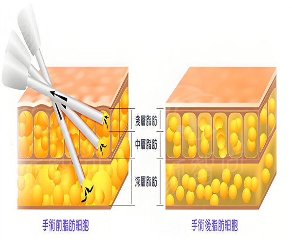 6f7737e56cc5e3a39234f70db8995c0b_副本.jpg