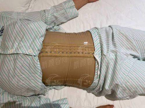 四、哈尔滨臻美全身吸脂怎么预约？医生团队靠谱吗？