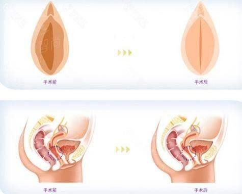 四、石家庄雅芳亚私密整形如何选择与预约？