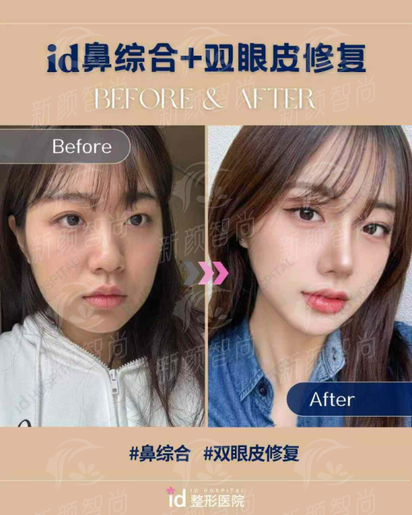 上海爱尚丽格张诗若眼修复技术靠谱吗？医生经验+术后效果全解析！ -上新颜智尚小程序查询/咨询快捷预约
