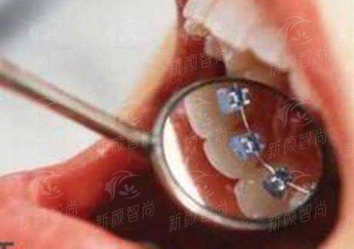 榆林靖边牙博仕口腔门诊部怎么样？看这几点就知道专业靠谱，新颜智尚小程序预约挂号更便捷，轻松搞定看牙难题！