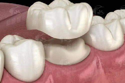 五、深圳格伦菲尔口腔医院(宝安宝中院区)：真实实例分享，街坊邻居都说好