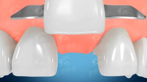 六、为什么要选择<strong>广州穗华口腔医院（花都院区）</strong>？预约挂号指南