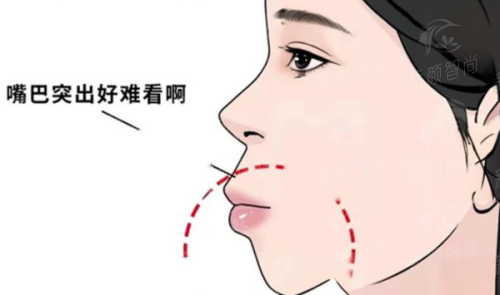 二、深圳格伦菲尔口腔医院(宝安宝中院区)：硕博医生天团，技术硬核不玩虚的