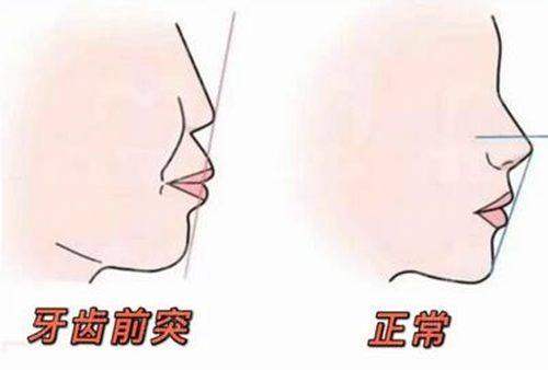 探店广州爱顿健业口腔健强店，洗牙美白套餐性价比超高；新颜智尚小程序线上预约已开启，一键锁定美丽笑容
