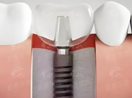 六、深圳格伦菲尔口腔医院(宝安宝中院区)：预约挂号指南，省时省力更省心