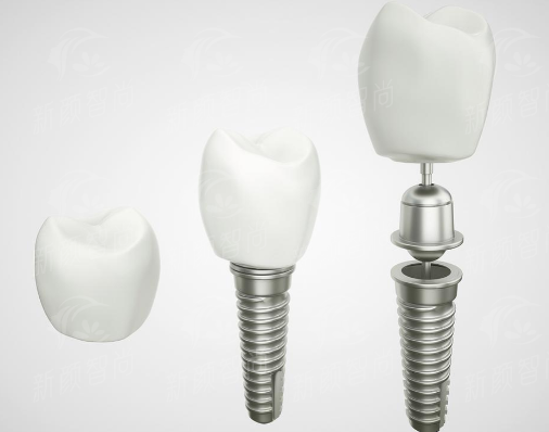 二、<strong>广州穗华口腔医院（花都院区）</strong>：数字化黑科技加持，看牙精细度“秒杀”传统