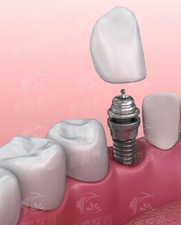 四、湘西永顺河西医院眼视光中 心：2026年收费价格表公开，性价比之选