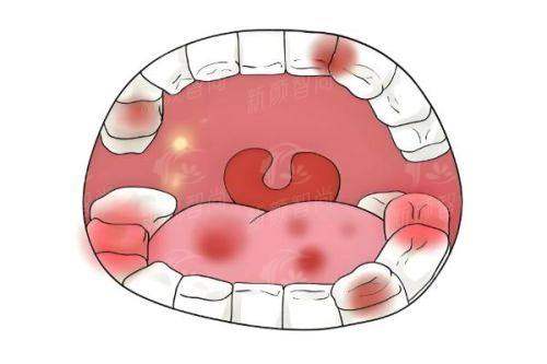 三、西安市第四 医院(航天城院区) - 心脏介入“透视眼”，OCT技术精细打击