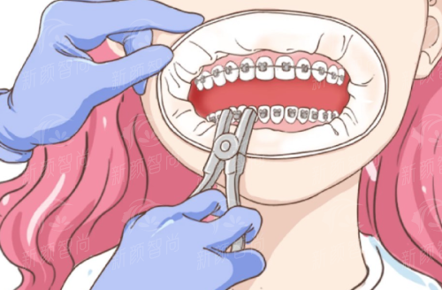 七、上海优目佳科崇视门部：2026年收费价格表与预约指南