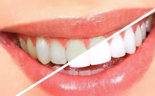 三、名咖坐镇，国有三等甲的技术“护城河”