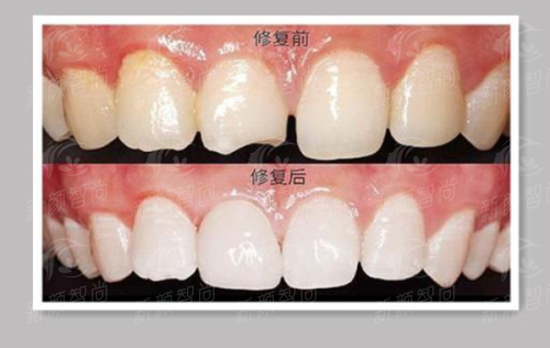 打卡深圳正恩口腔(羅湖總店)：種植/矯正/美牙一站式，新顏智尚小程序預約掛號不踩坑