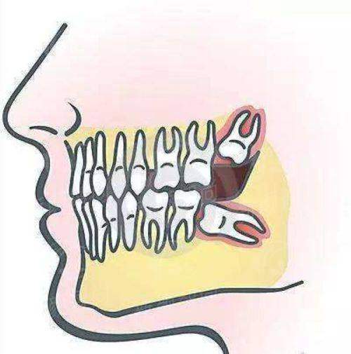 六、<strong>深圳正恩口腔（羅湖總店）</strong>真实实例：听听大家怎么说