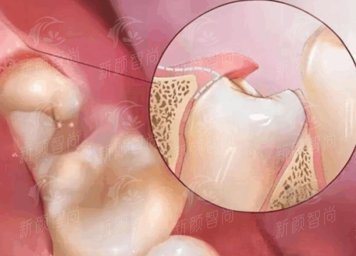 深圳希玛爱康健口腔医院（福田口岸店）六、真实顾客实例分享，口碑见证品质