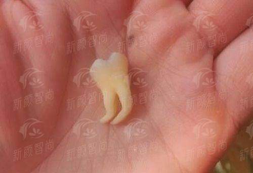 四、深圳罗湖区人民医院(春风院区)口腔科：从“哄娃”到“跨境”，服务细节温暖人心