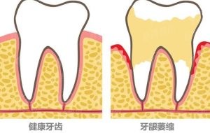 五、深圳市希华爱康健医院口腔科：真实实例分享，听听他们怎么说