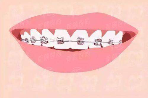 六、上海优目佳科崇视门部：真实实例分享，口碑见证实力