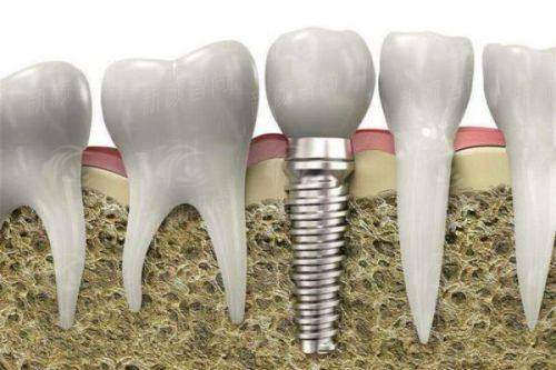 天津阳光树口腔门诊部（滨海院区）六、告别看牙恐惧，舒适化服务体验升级