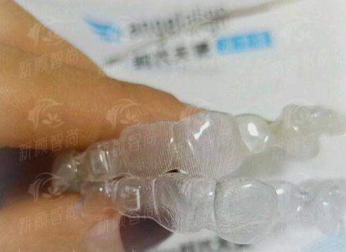 深圳江南格伦菲尔口腔罗湖院区怎么样？看牙不踩坑，专业种植牙/矫正案例大揭秘，新颜智尚小程序预约挂号更便捷