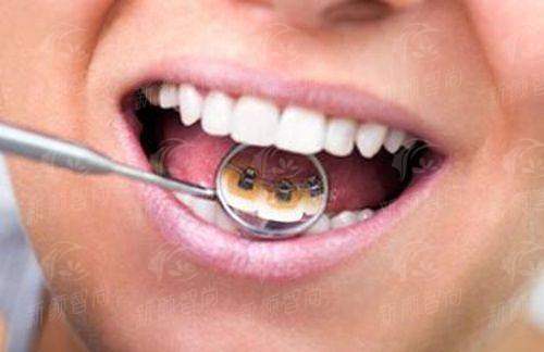 二、深圳正夫口腔医院(水贝IBC店)：数字化黑科技VS传统牙科，这波“降维打击”太狠了