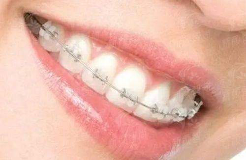 五、<strong>深圳正恩口腔医院(罗湖总店)</strong>真实口碑：温柔看诊不推销，患者直呼真香