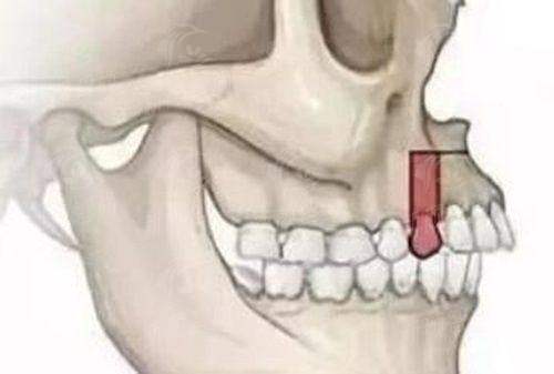六、上海伊美尔毛发移植医院：VIP式宠粉服务，从进院到出院全程无忧