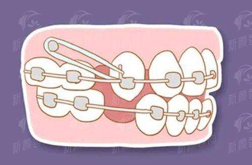 三、深圳柏齿康口腔门诊部（罗湖院区）——从业多年团队坐诊，私密诊疗体验拉满