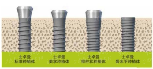 五、深圳鼎植口腔医院(罗湖口岸旗舰店)口碑与实例：真实好评，见证实力