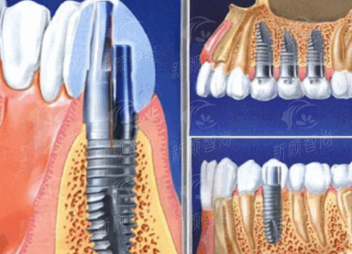 深圳爱康健口腔医院（罗湖院区）三、硕博骨干医生团坐镇，平均医龄超10年的“技术流”