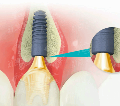 六、西安市第四 医院(航天城院区) - 真实口碑见证，患者都说好