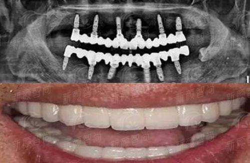 六、深圳市希华爱康健医院口腔科：预约挂号指南，看牙不排队