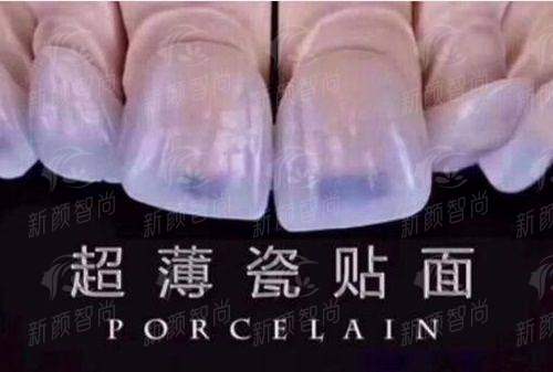 打卡福田口岸牙科！深圳希玛爱康健口腔医院医生团队揭秘，新颜智尚小程序预约更省心