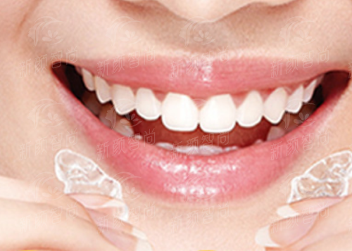 天津阳光树口腔门诊部（滨海院区）四、2026年价格表公开，收费透明性价比高