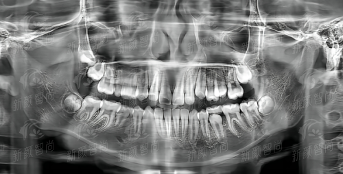四、昆山爱尔眼鼻喉医院：屈光与白内障，重获高清视界