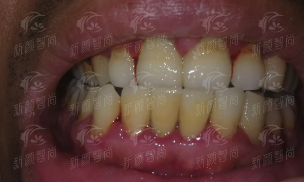 六、深圳正恩口腔(罗湖总店)：覆盖深圳多区，24小时在线预约更便捷