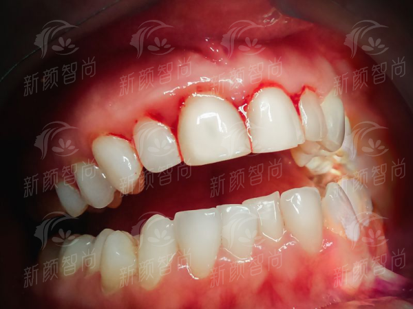 四、<strong style="color: red;">深圳鼎植口腔医院(罗湖口岸旗舰店)</strong>价格透明：2026年全新收费表，拒绝隐形消费