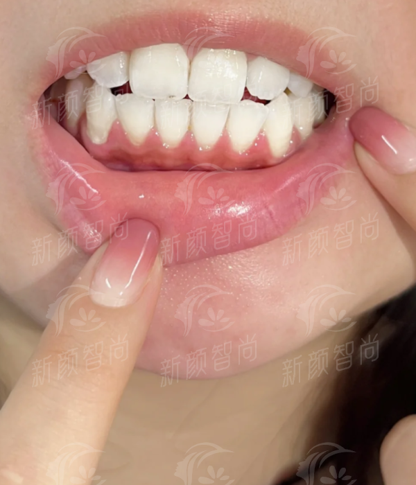 深圳爱康健口腔医院罗湖院区看牙贵不贵？医保定点+透明收费，上新颜智尚小程序挂号不踩坑