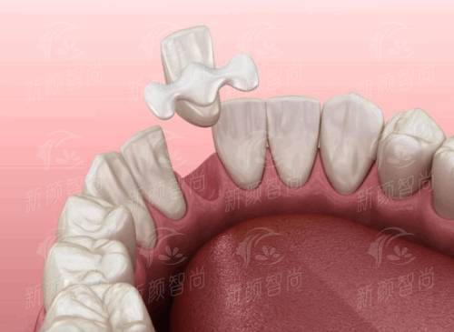 三、深圳正夫口腔医院(水贝IBC店)：硕博骨干医生领衔，医生天团技术“天花板”
